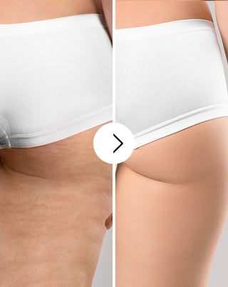 Tablete za celulit i poboljšanje stanja kože s prirodnim ekstraktima Cellinea, 60 kapsula_3 - 3