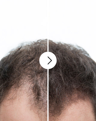 Kapsule protiv opadanja kose s učinkom zgušnjavanja i jačanja Follixin 60 kapsula - 6