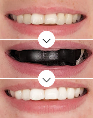 Trake za izbjeljivanje zubi The White(ning) Stripes Smilebite set 28 kom.