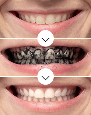Prah za izbjeljivanje zubi od kokosovog ugljena Smilebite