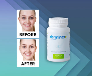 Tablete za akne, prištiće i nesavršenosti sa cinkom, vitaminom C, E i B2 Derminax - 2