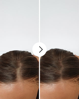 Kapsule protiv opadanja kose s učinkom zgušnjavanja i jačanja Follixin 60 kapsula