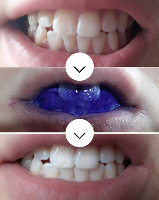 Serum za izbjeljivanje zubi White Bite Smilebite 30 ml - 2